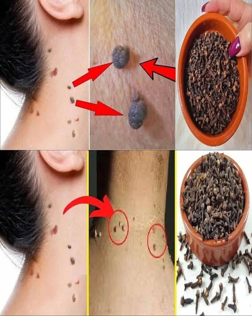 Et Beninin Dogal Yollar Düşürmek